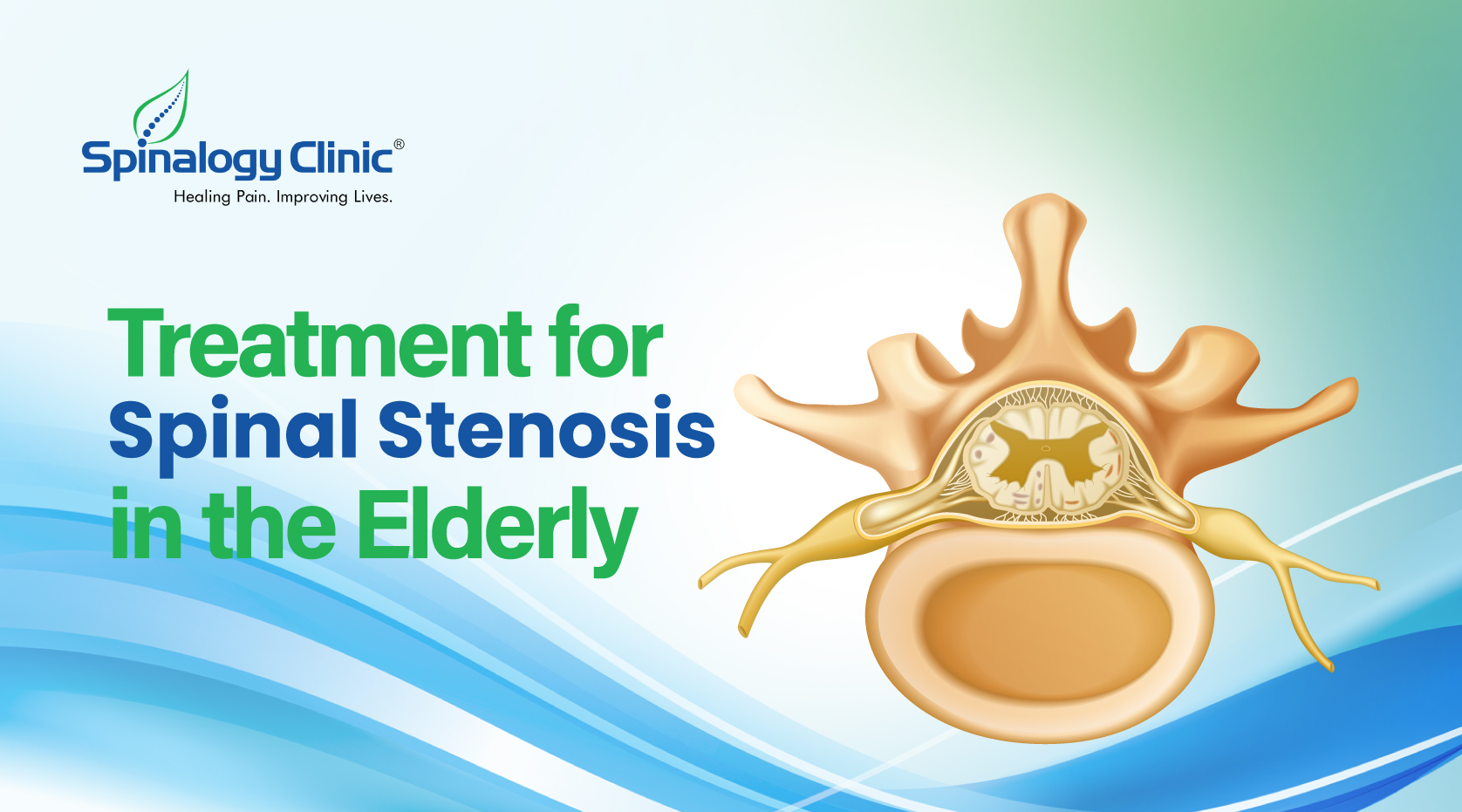 Treatment for Spinal Stenosis in the Elderly: Here's What to Know